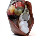 Jaypee Brothers Oral & Maxillofacial Surgery eBook 3rd Edition Kindle-0