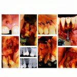 Springer Oral and Maxillofacial Surgery eBook 266‑Page Guide-0
