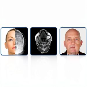 Oral & Maxillofacial Surgery eBook OUP Oxford Challenging Concept-0