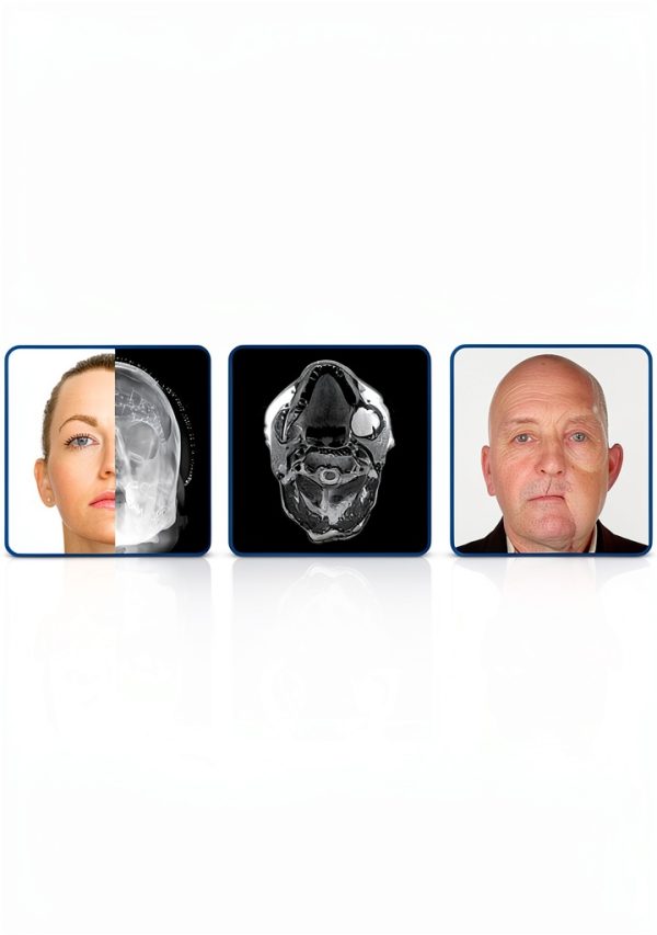 Oral & Maxillofacial Surgery eBook OUP Oxford Challenging Concept-0